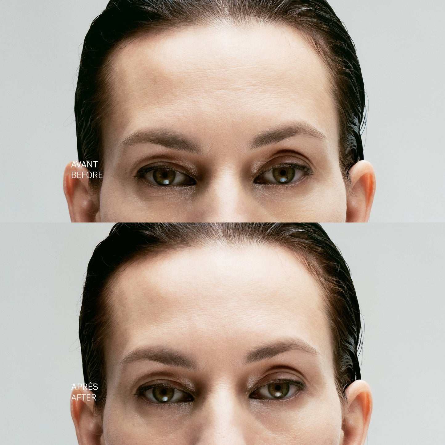 Concentré Local Tenseur A43
Complexe de peptides inhibiteurs 10% + Acide hyaluronique