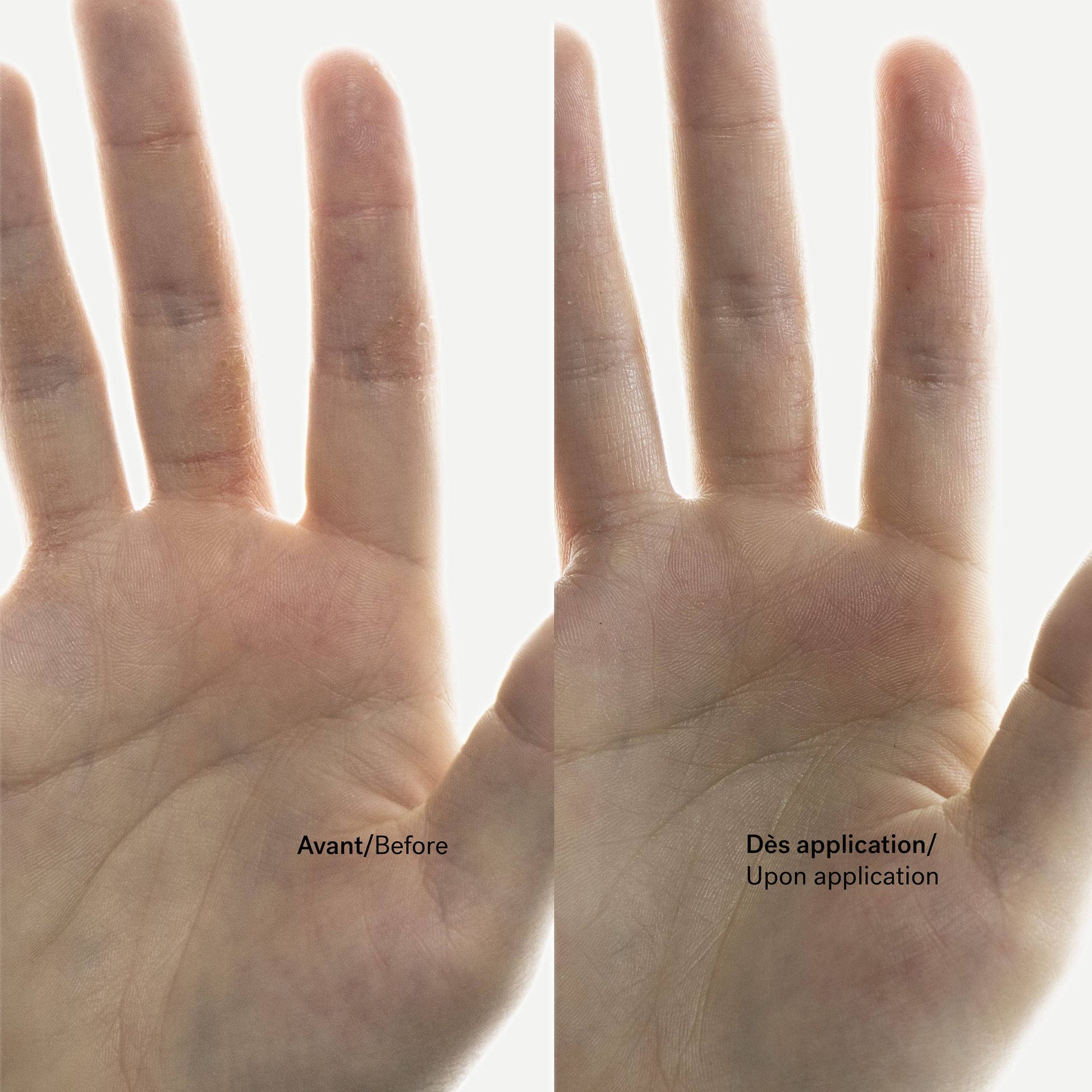 Crème Anti-Démangeaisons C93
Énoxolone 0,15% + Bisabolol