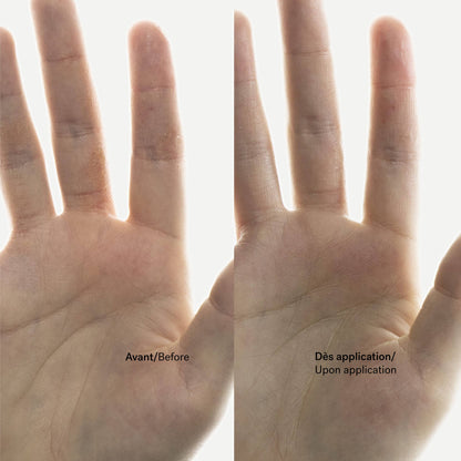 Crème Anti-Démangeaisons C93
Énoxolone 0,15% + Bisabolol