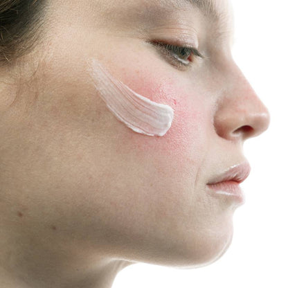 Crème Visage Anti-Rougeurs C40
Acide azélaïque 5% + Niacinamide